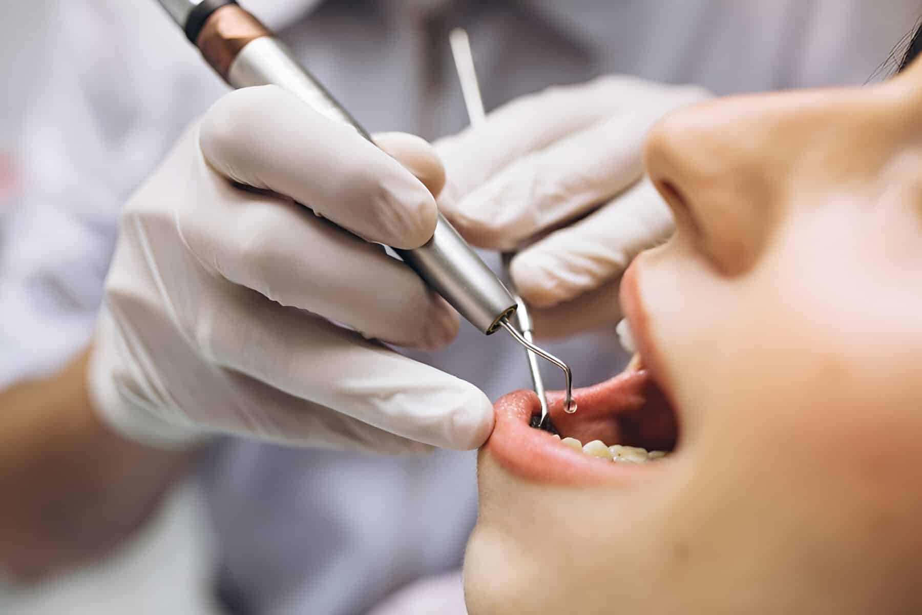 Jovem moça sendo atendida por dentista - Unijorge Paralela/Odontologia